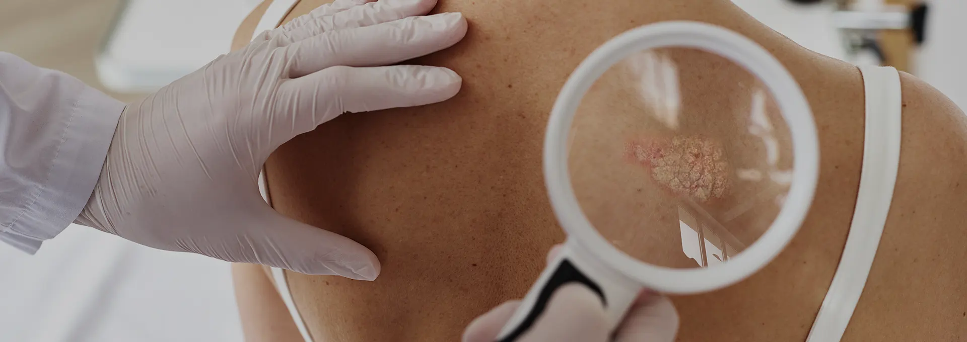 Debarrassez-vous des parasites